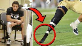 These-NFL-Players-Have-a-Disability-attachment